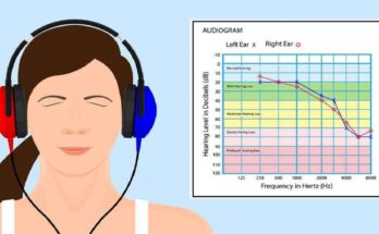 Audiometry